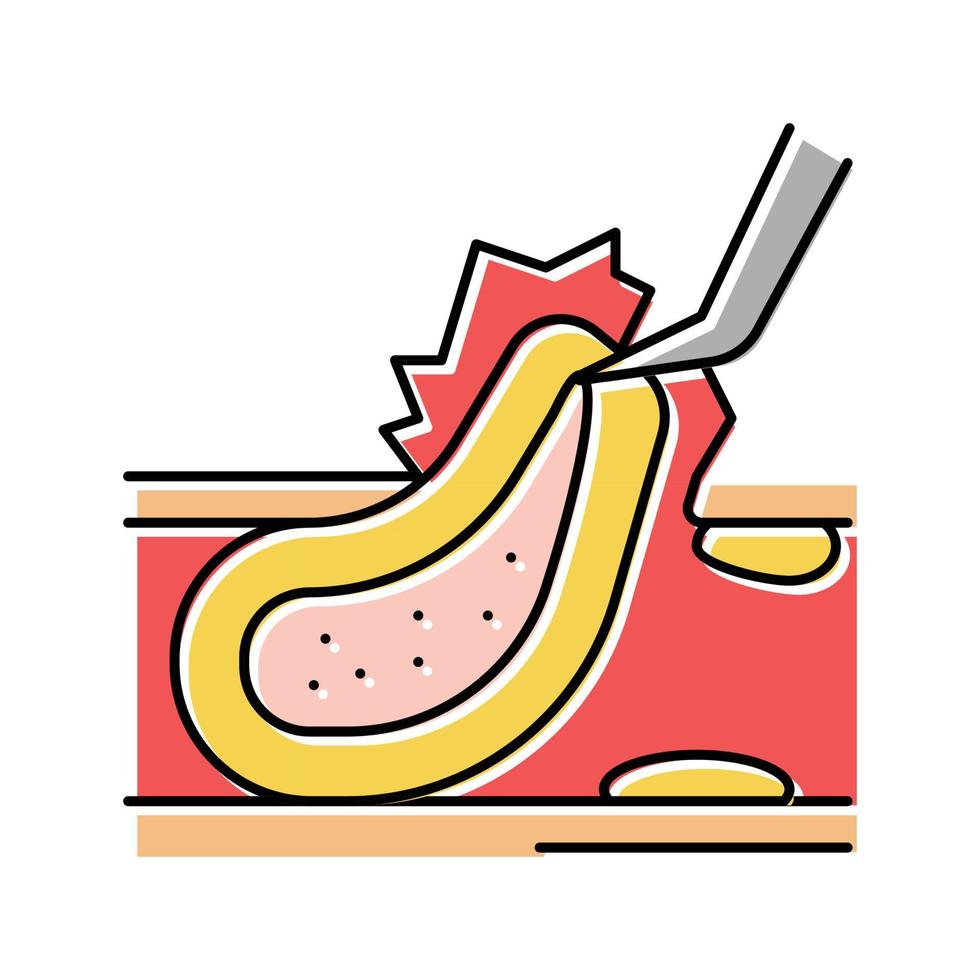 carotid endarterectomy color icon vector illustration