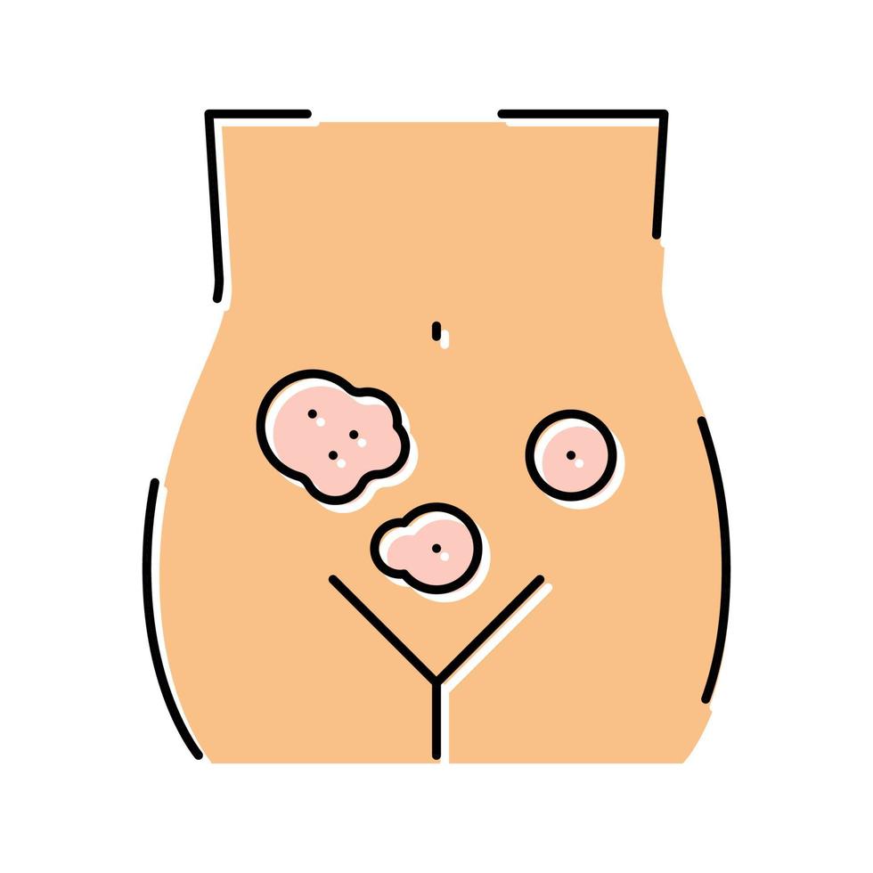ilustración de vector de icono de color de clínica de dermatología genital