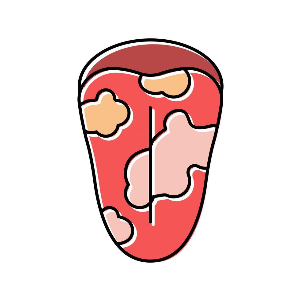 ilustración de vector de icono de color de enfermedad de glositis