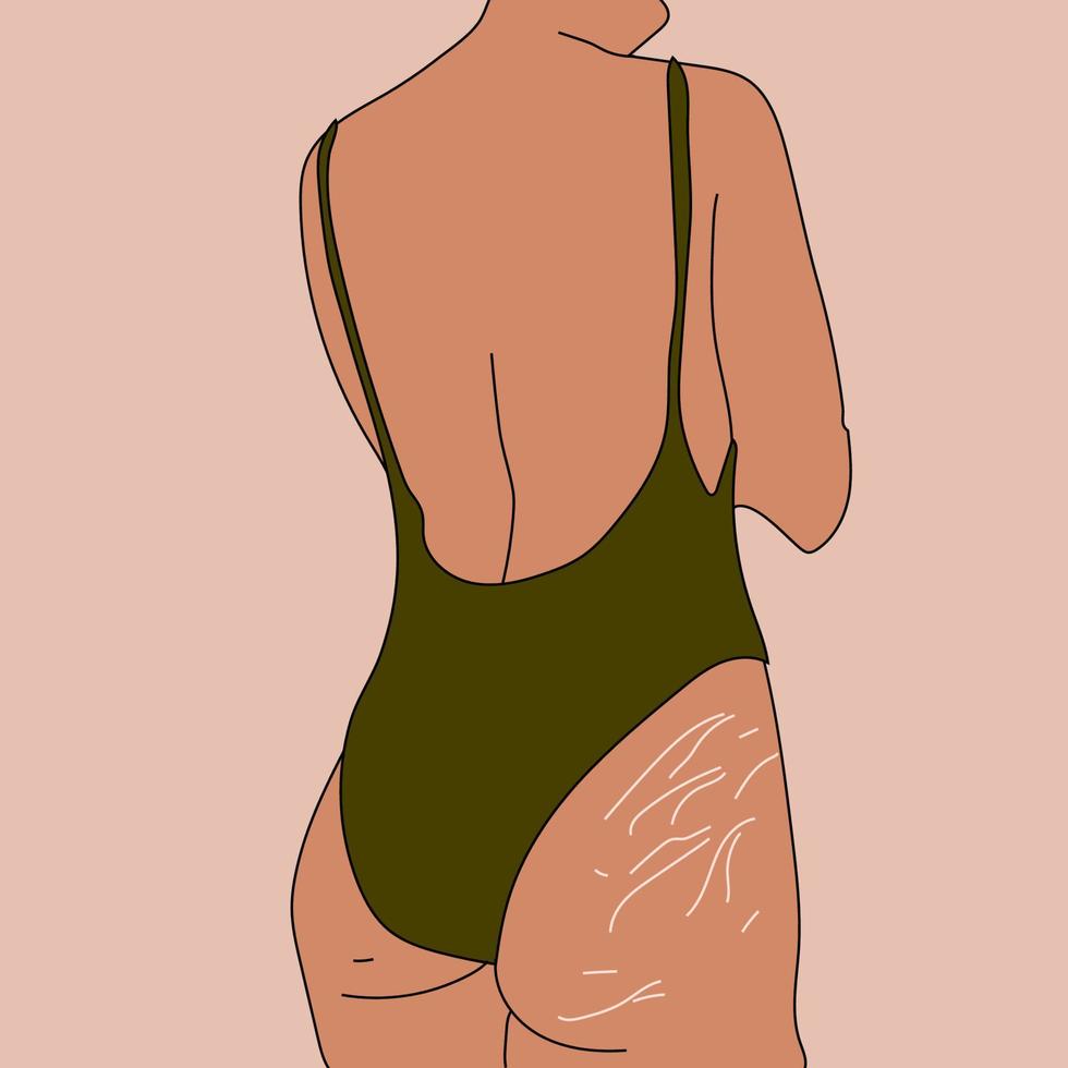 mujer con estrías. amor propio y concepto positivo del cuerpo. ilustración vectorial en estilo plano vector