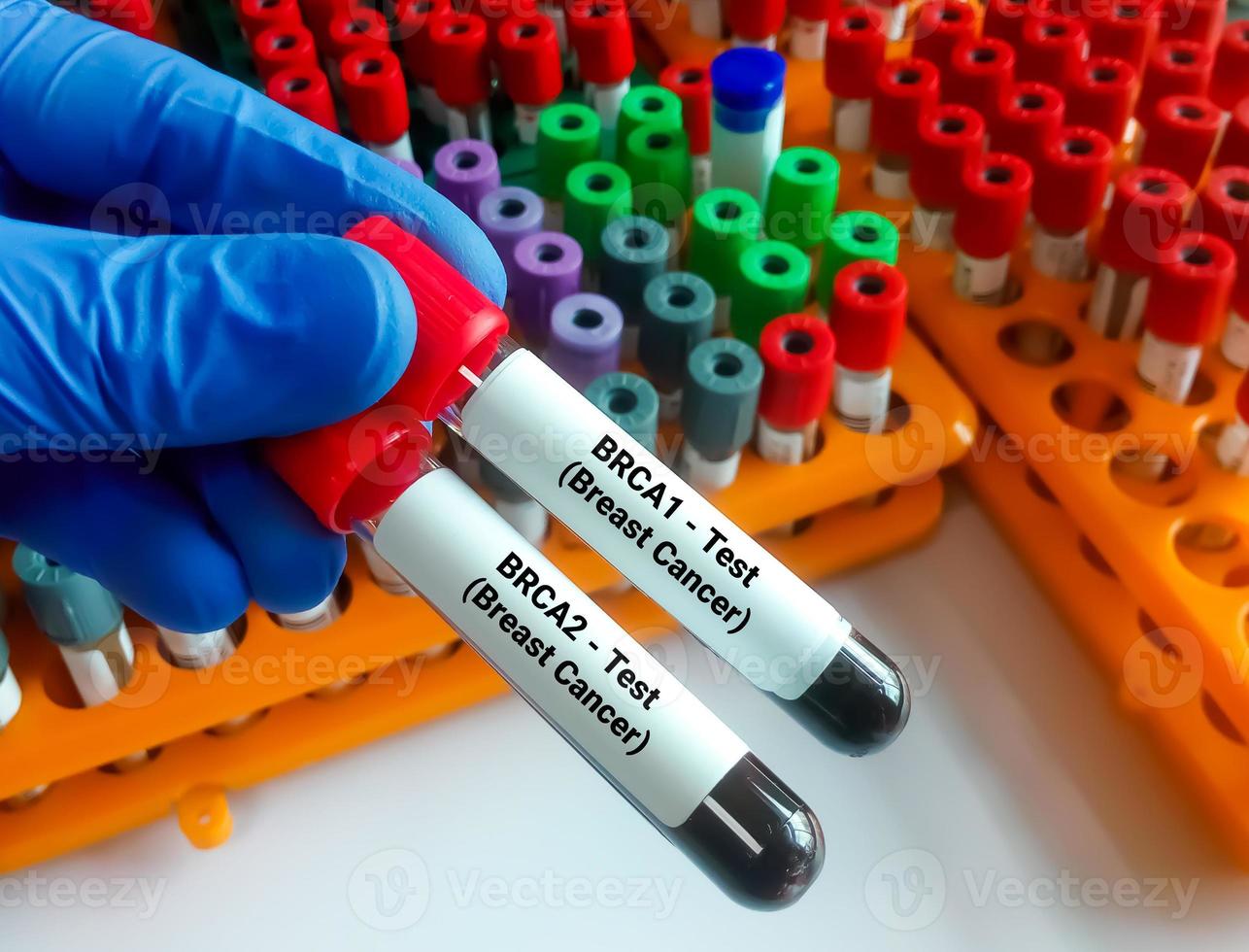 BRCA1 and BRCA2 are two genes that are important to fighting cancer called tumor suppressor genes. Breast cancer. photo