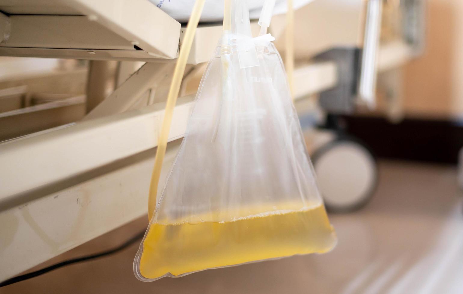 The urine or pee catheter bag hang under patient bed in hospital