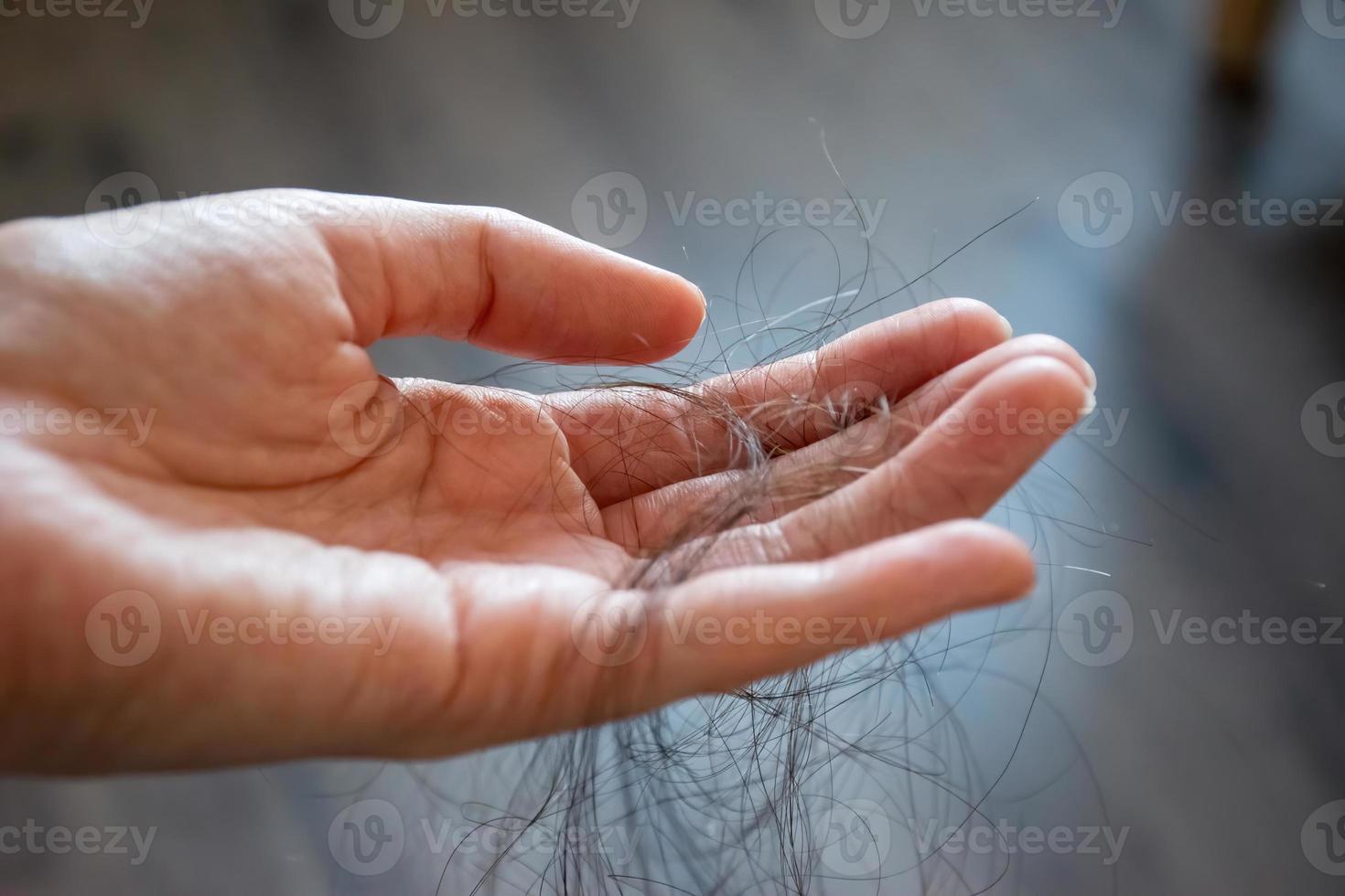 Hair loss concept. photo