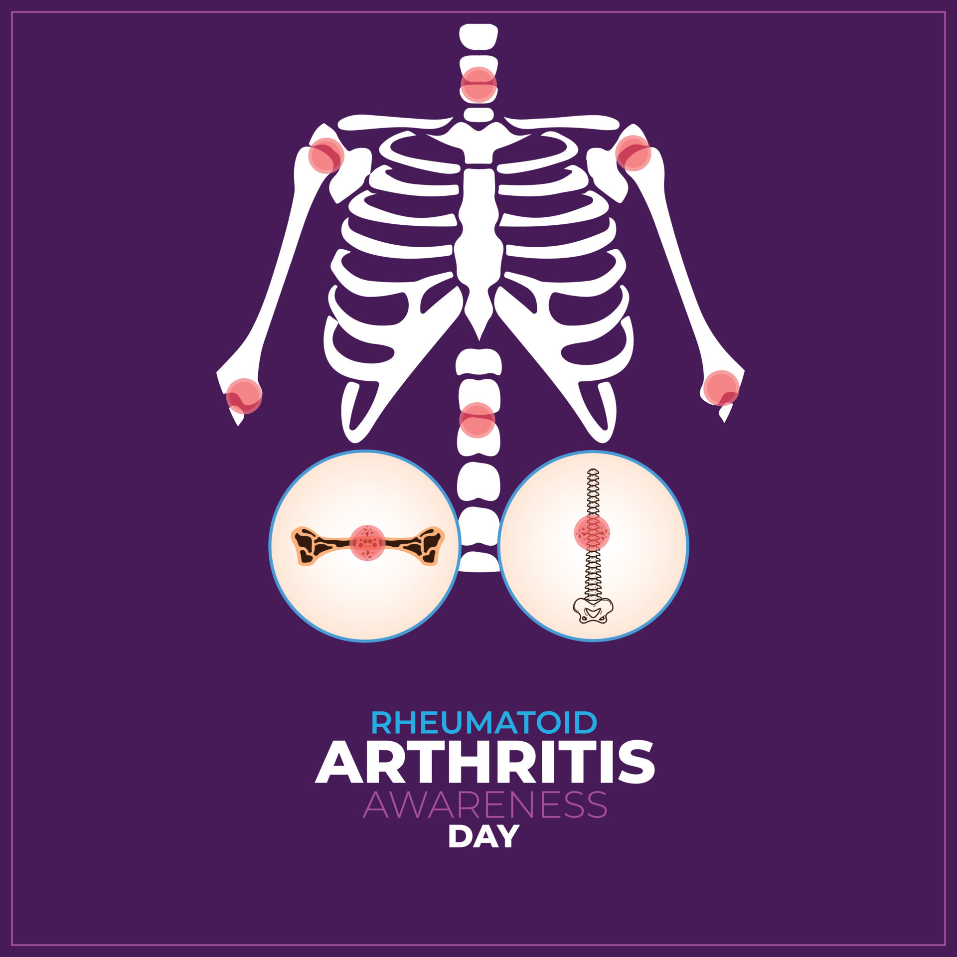 Rheumatoid Arthritis Awareness Day. 2 February. Template for background