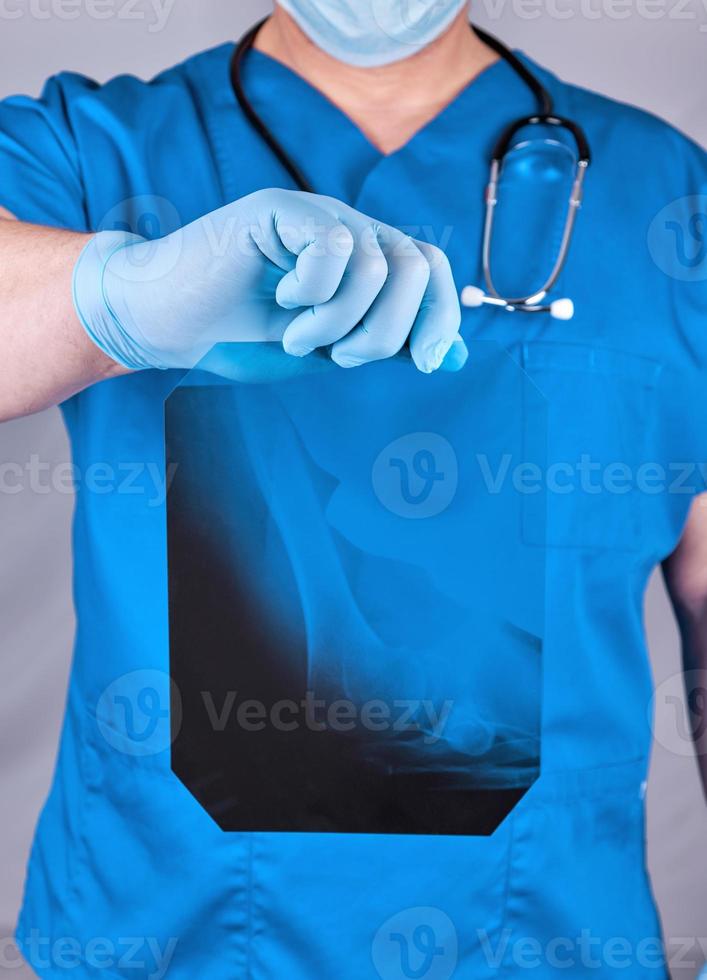 médico en azul uniforme y látex guantes participación un hueso radiografía foto