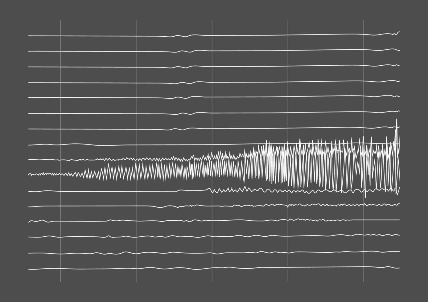 ilustración de ictal eeg grabación durante incautación vector