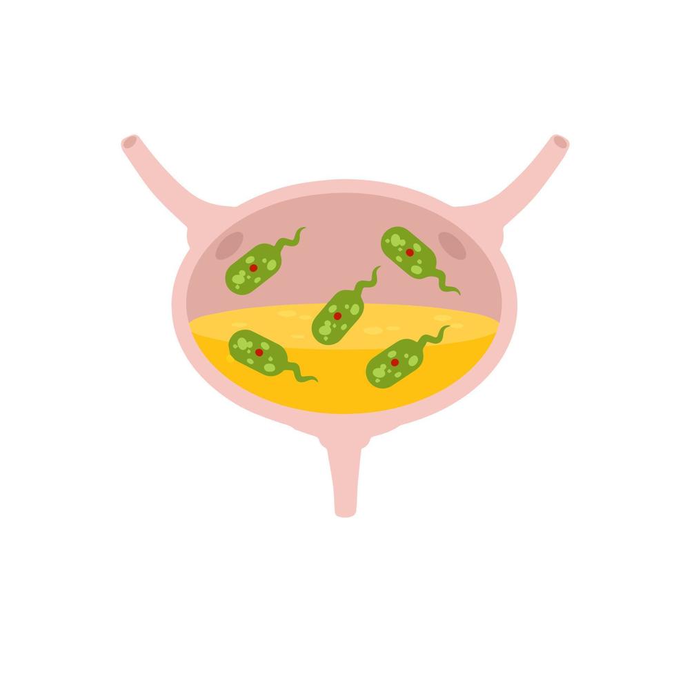 Virus in the bladder. Infection and inflammation of urine and internal organ. Medical problem and illustration. Green virus and bacteria. vector