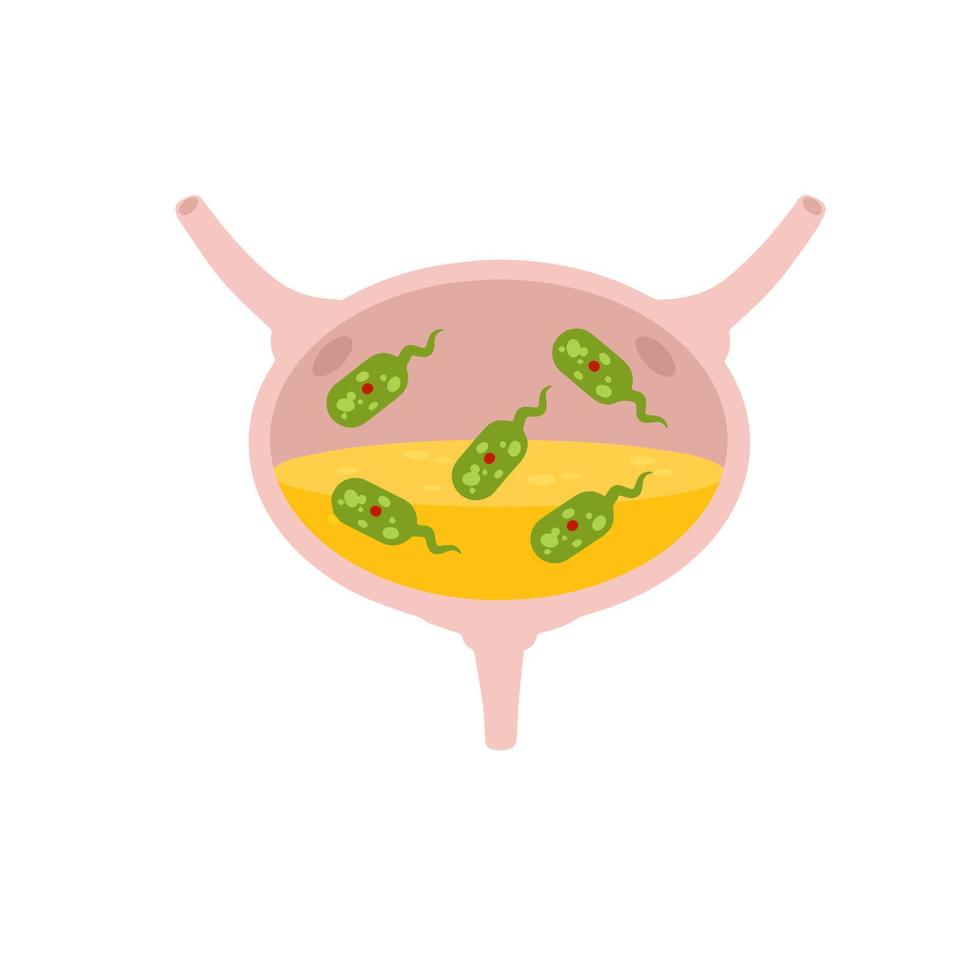 virus en la vejiga. infección e inflamación de la orina y órganos internos. problema médico e ilustración. virus verde y bacterias. vector