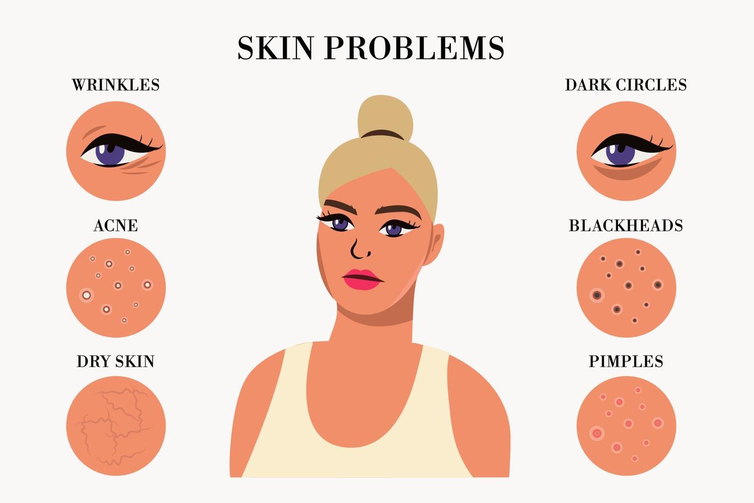 triste mujer y conjunto de más común hembra facial piel problemas necesidades a cuidado acerca de acné, espinillas, arrugas, seco piel, puntos negros, oscuro círculos debajo ojos. vector