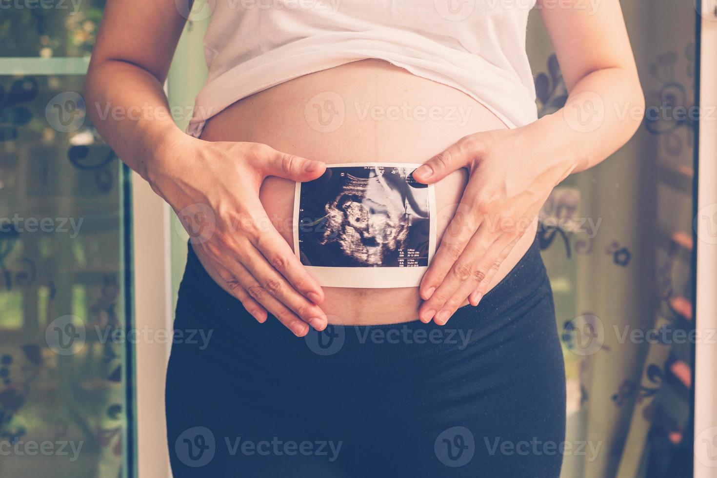 Close up hand pregnant woman holding ultrasound scan on tummy photo