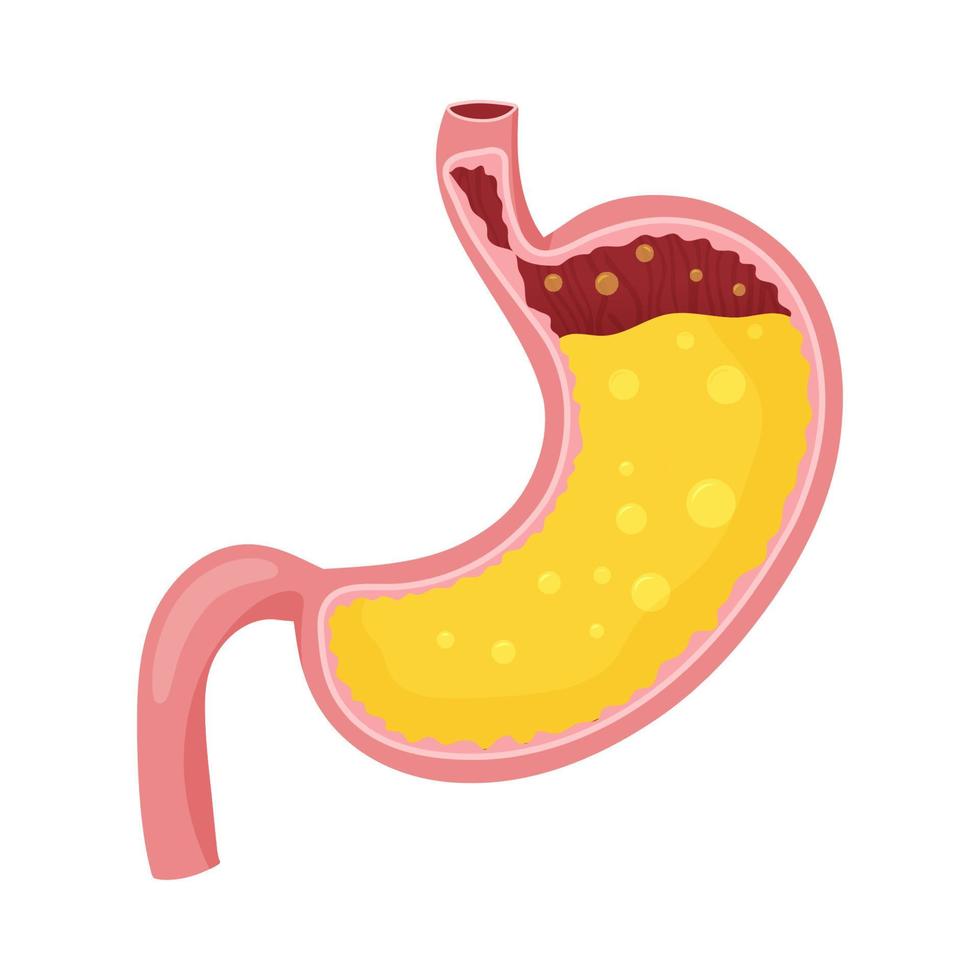 Human stomach full of gastric juice vector