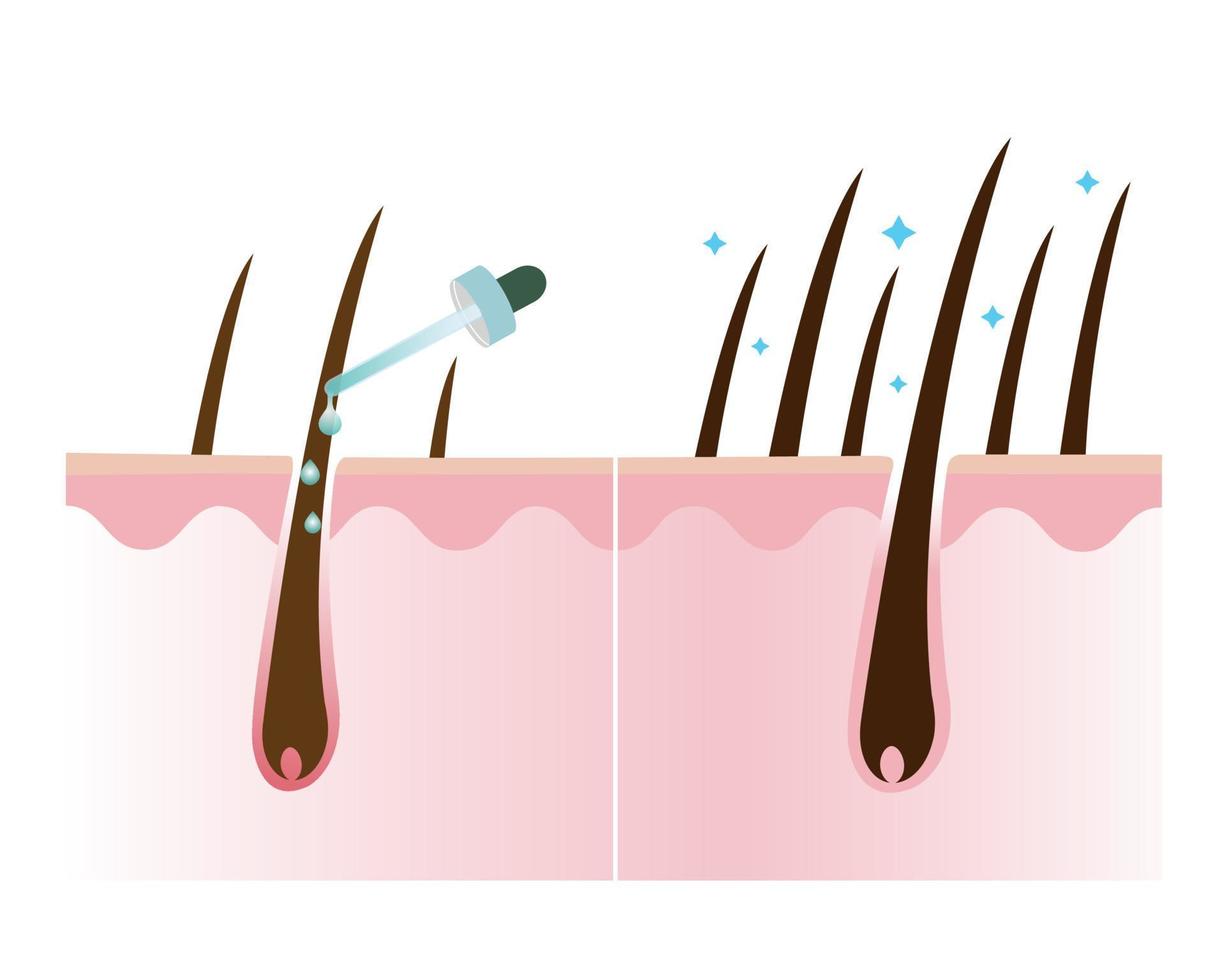 pelo densidad tratamiento vector ilustración aislado en blanco antecedentes.