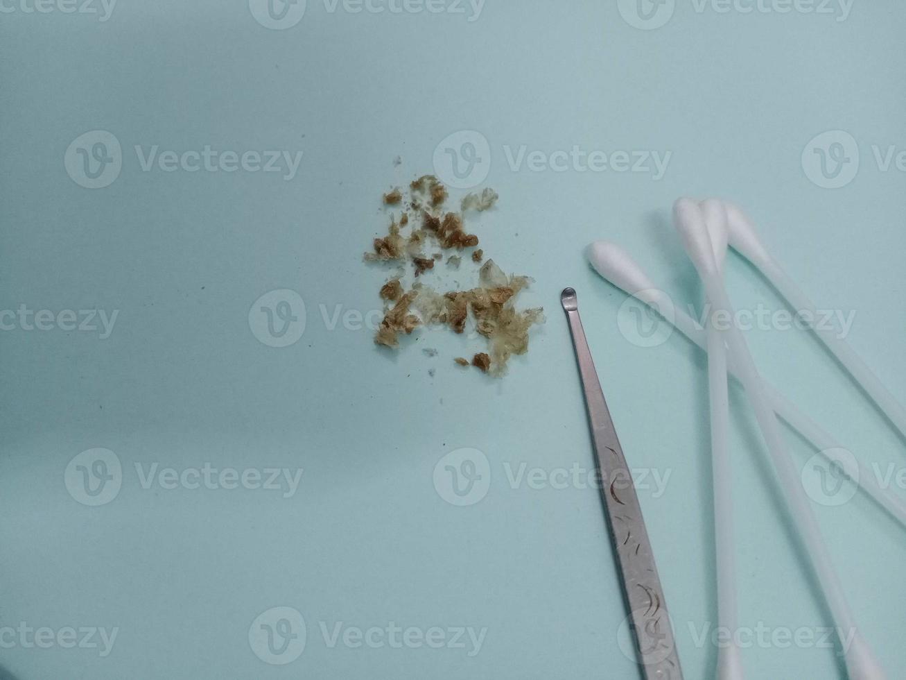 Earwax, earwax, cotton swabs, on a light blue table photo