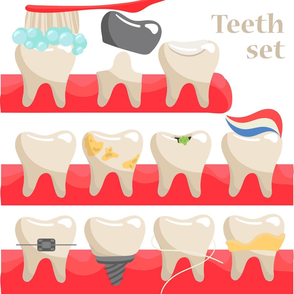 A set of human teeth with various injuries. Healthy and diseased tooth, caries, broken root, plaque, spots, crack. Banner, poster for printing. Infographics in dentistry. Vector. Flat style vector