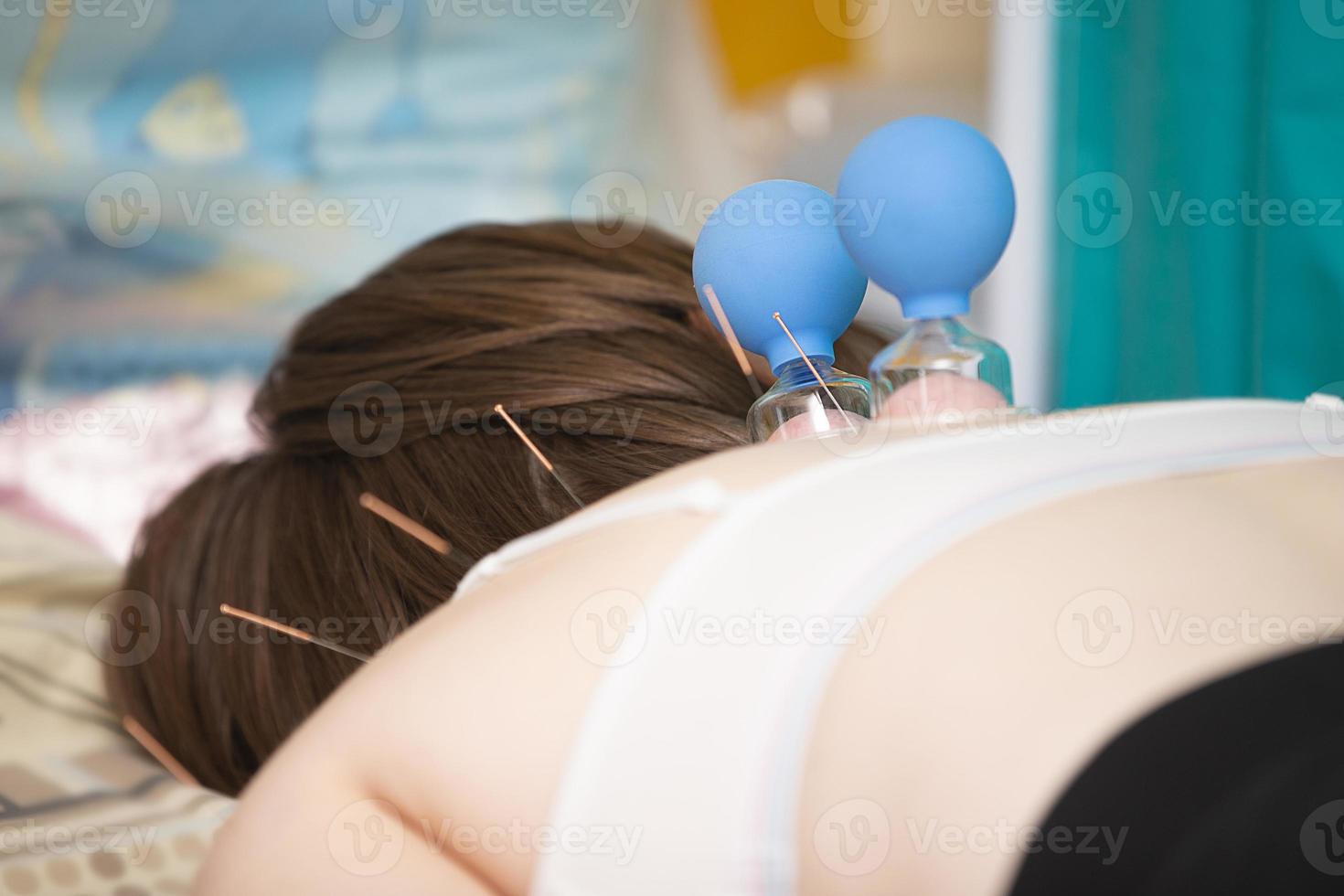 The doctor makes the patient acupuncture and vacuum massage. photo
