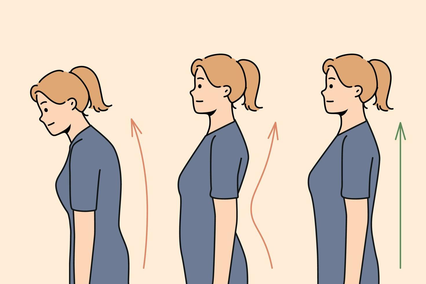 Set of young woman posture correction. Collection of female with and without back problems. Healthcare and physiotherapy. Vector illustration.