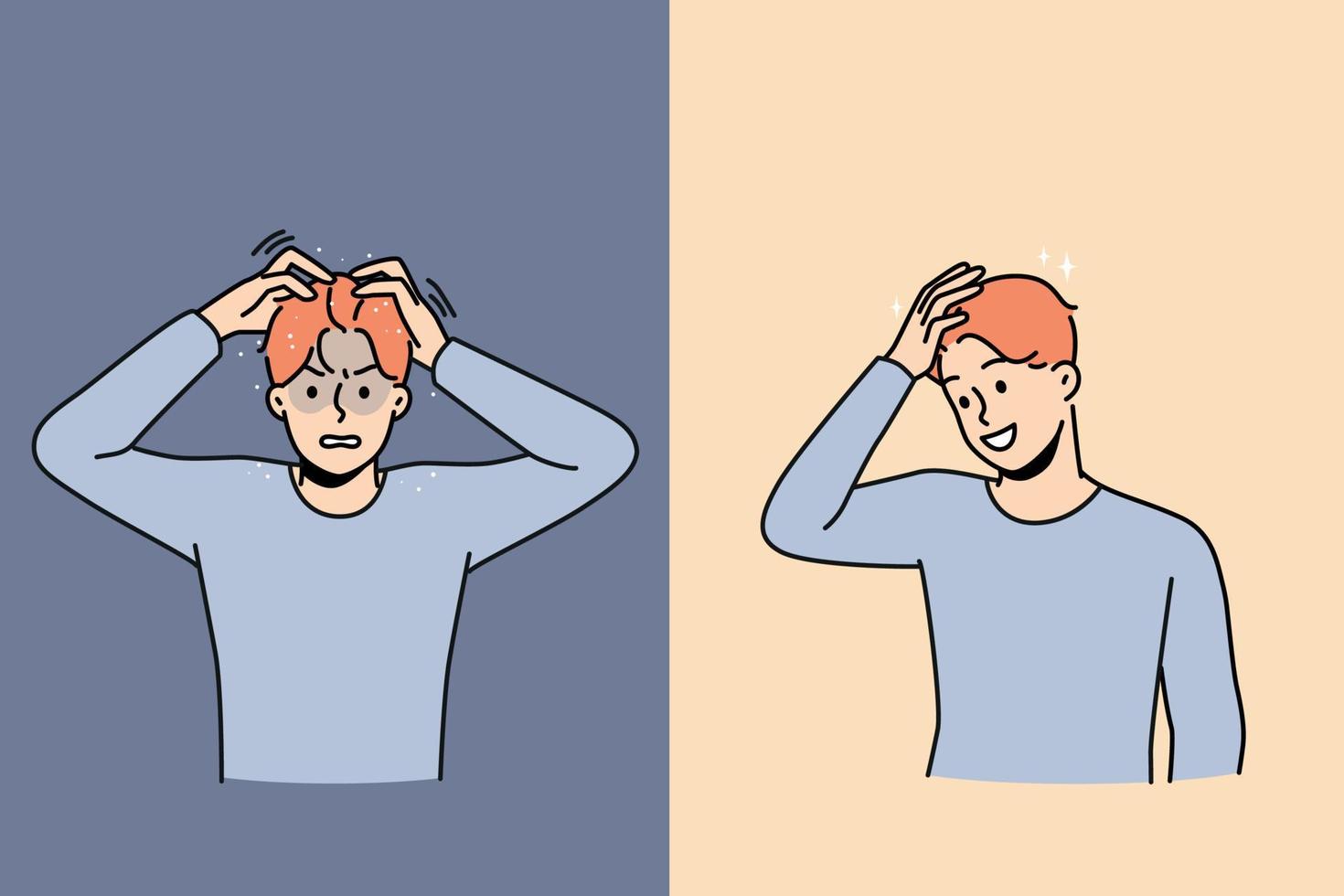 Set of young man suffer from dandruff versus excited with clean healthy hair after treatment. Concept of medical or beauty procedures for haircare. Vector illustration.