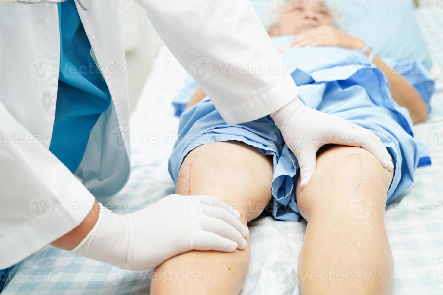 Doctor checking Asian elderly woman patient with scar knee replacement surgery in hospital. photo