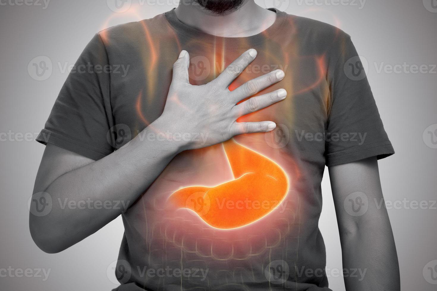 Acid reflux or Heartburn photo