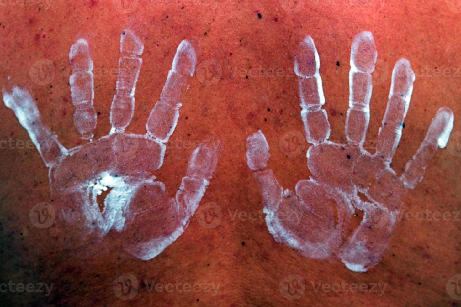 white hands shape on skin photo