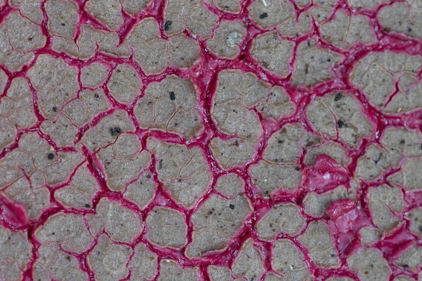 covid19 lung coronavirus virus affected macro photo