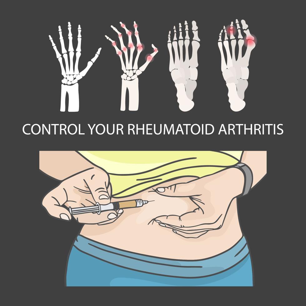 reumatoide artritis controlar inyección en estómago vector conjunto