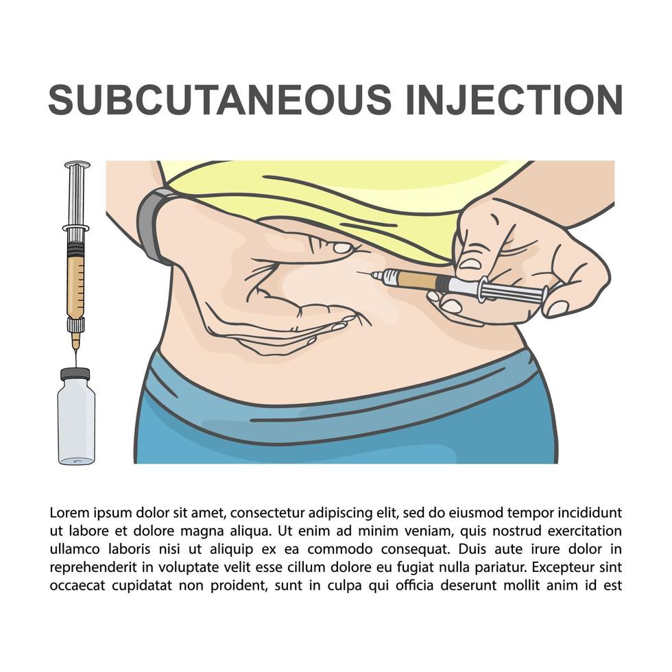 subcutáneo inyección en el abdomen vector ilustración conjunto