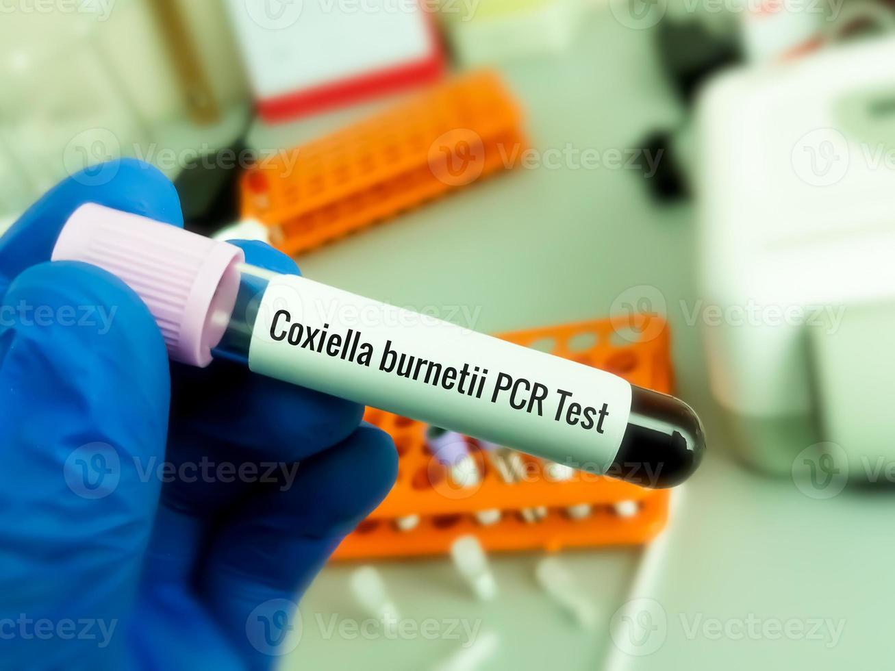 Blood sample for Q fever or query fever is a disease caused by infection with Coxiella burnetii. photo