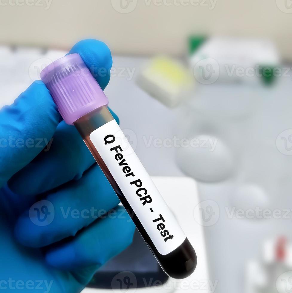 Blood sample for Q fever or query fever is a disease caused by infection with Coxiella burnetii. photo