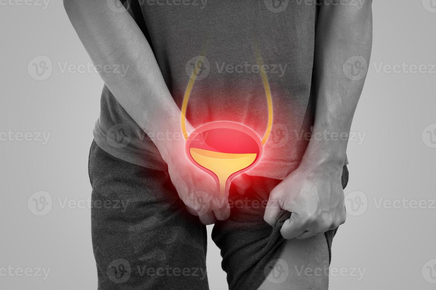 Man wants to pee and is holding his bladder, Frequent urination in men, Urinary hesitancy symptoms photo