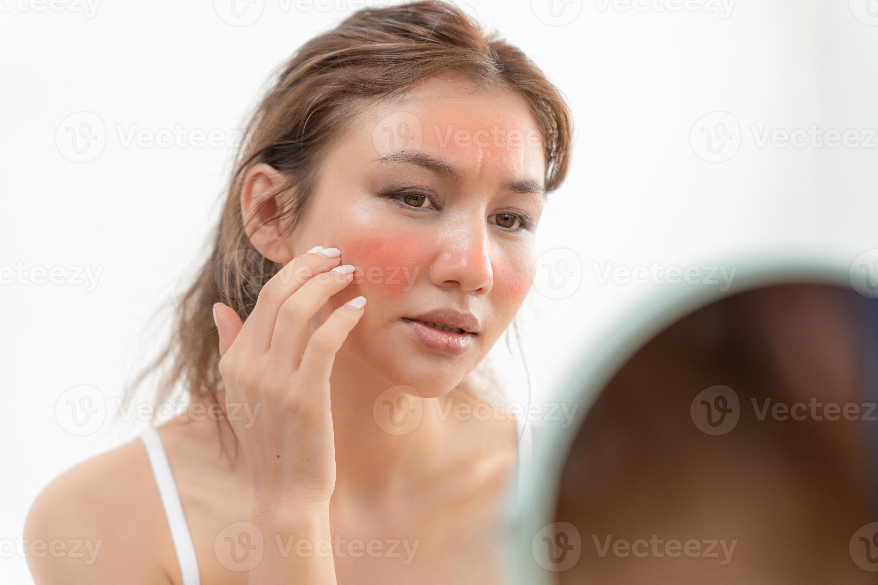 Young woman are worried about faces Dermatology and allergic to