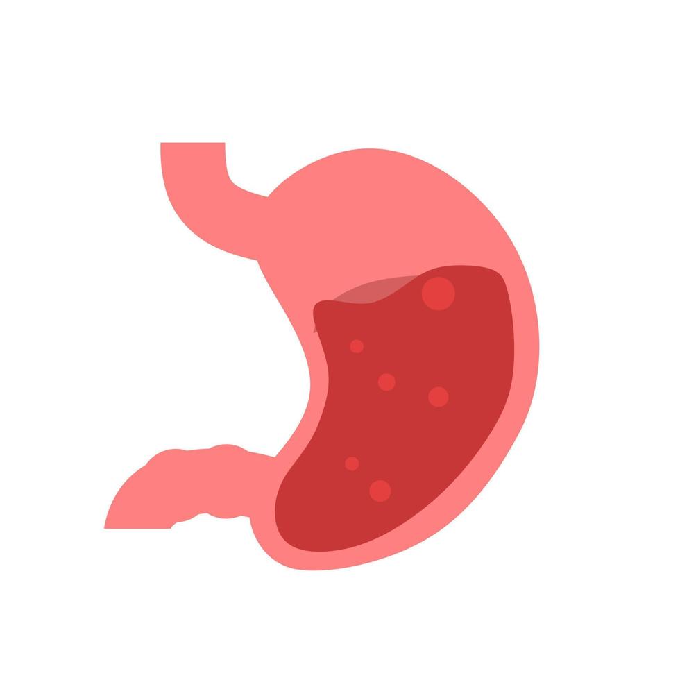 stomach. gastric disease. stomach ache. digestive process. gastric bacteria. gerd vector