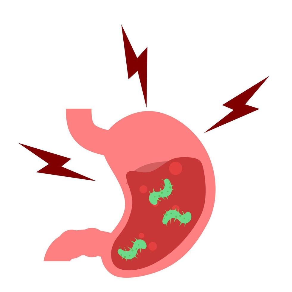 stomach. gastric disease. stomach ache. digestive process. gastric bacteria. gerd vector