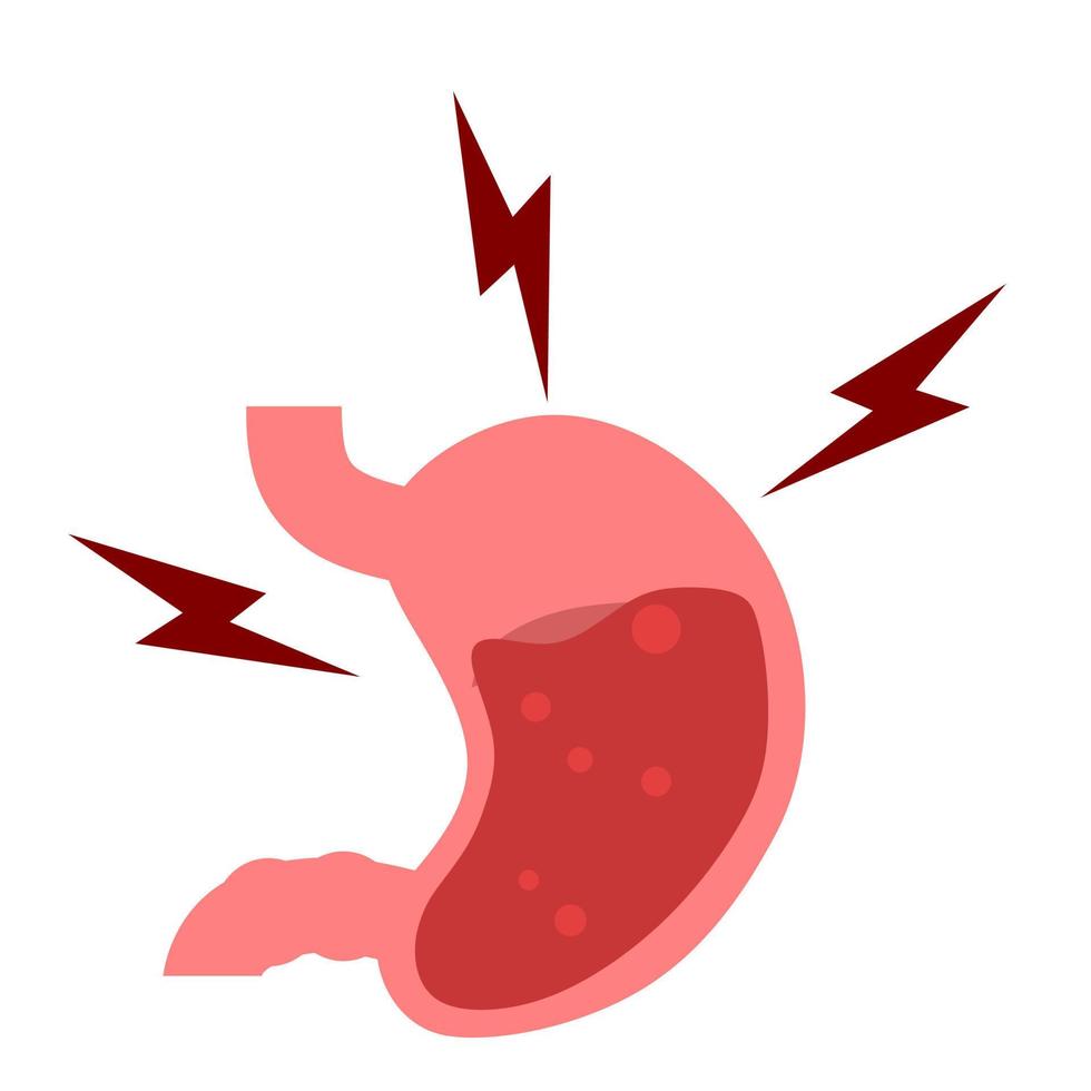 estómago. gástrico enfermedad. estómago dolor. digestivo proceso. gástrico bacterias gerd vector