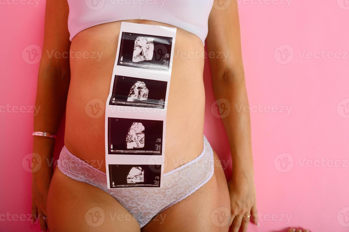 Pregnant mom shows an ultrasound of her son photo