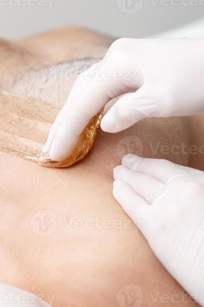 Epilation chest of young male photo