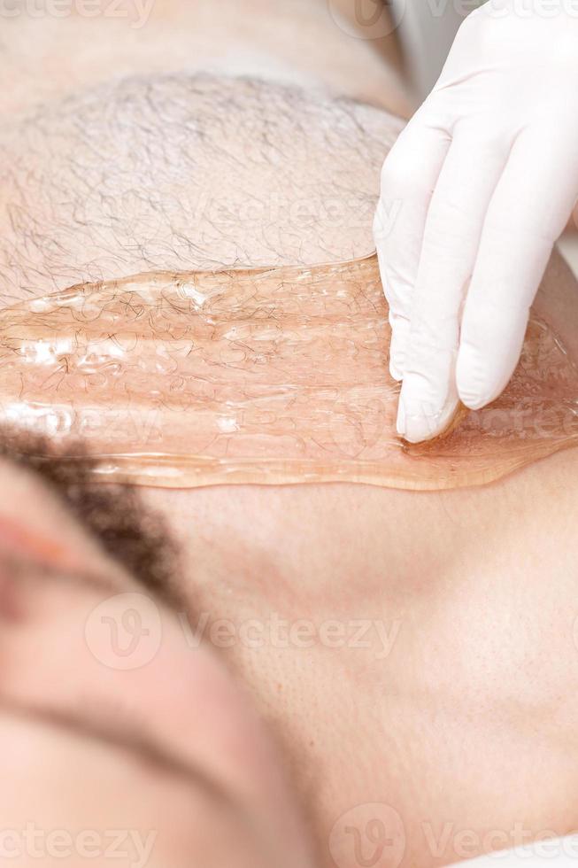 Epilation chest of young male photo