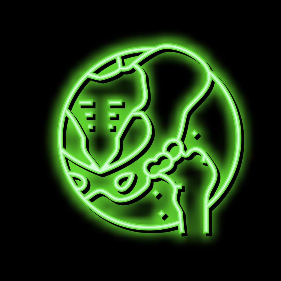 articular cartilage gout neon glow icon illustration vector