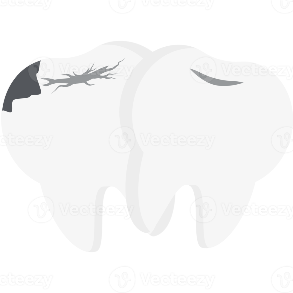 dubbel- tand bruten hålighet knäckt tänder png