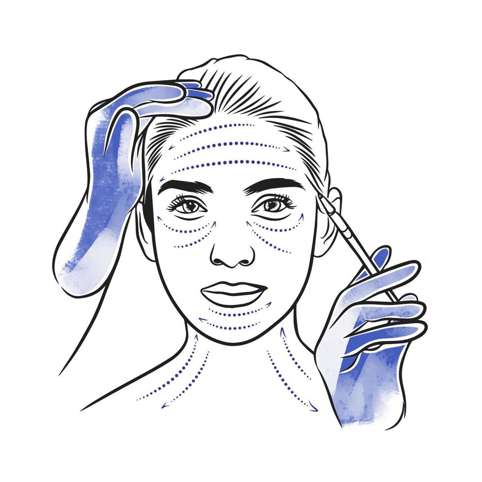 Botox, beauty injections, portrait of a girl with markup, syringe in gloved hands vector