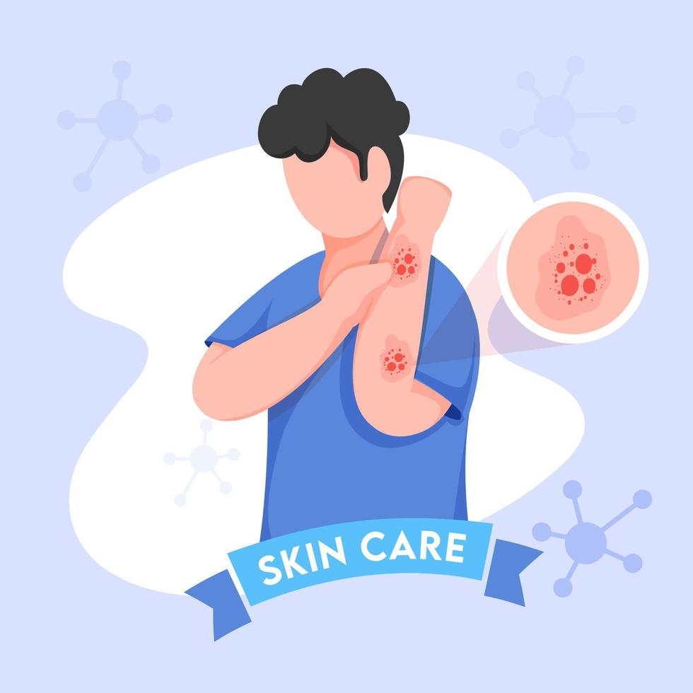 Cartoon Young Boy Itching His Hands and Molecules Decorated on Blue Background for Skin Care. vector