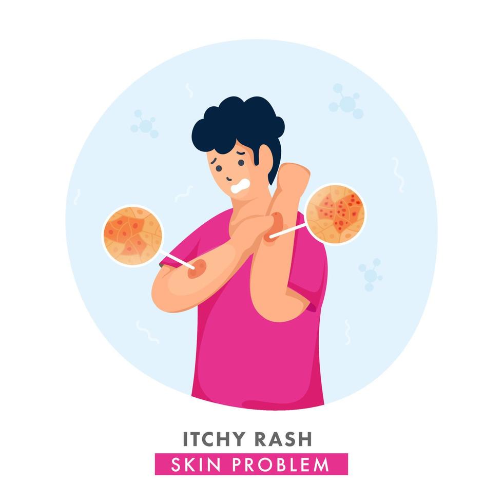 Cartoon Young Boy Itching His Hands And Showing Skin Rashes on White Background. vector