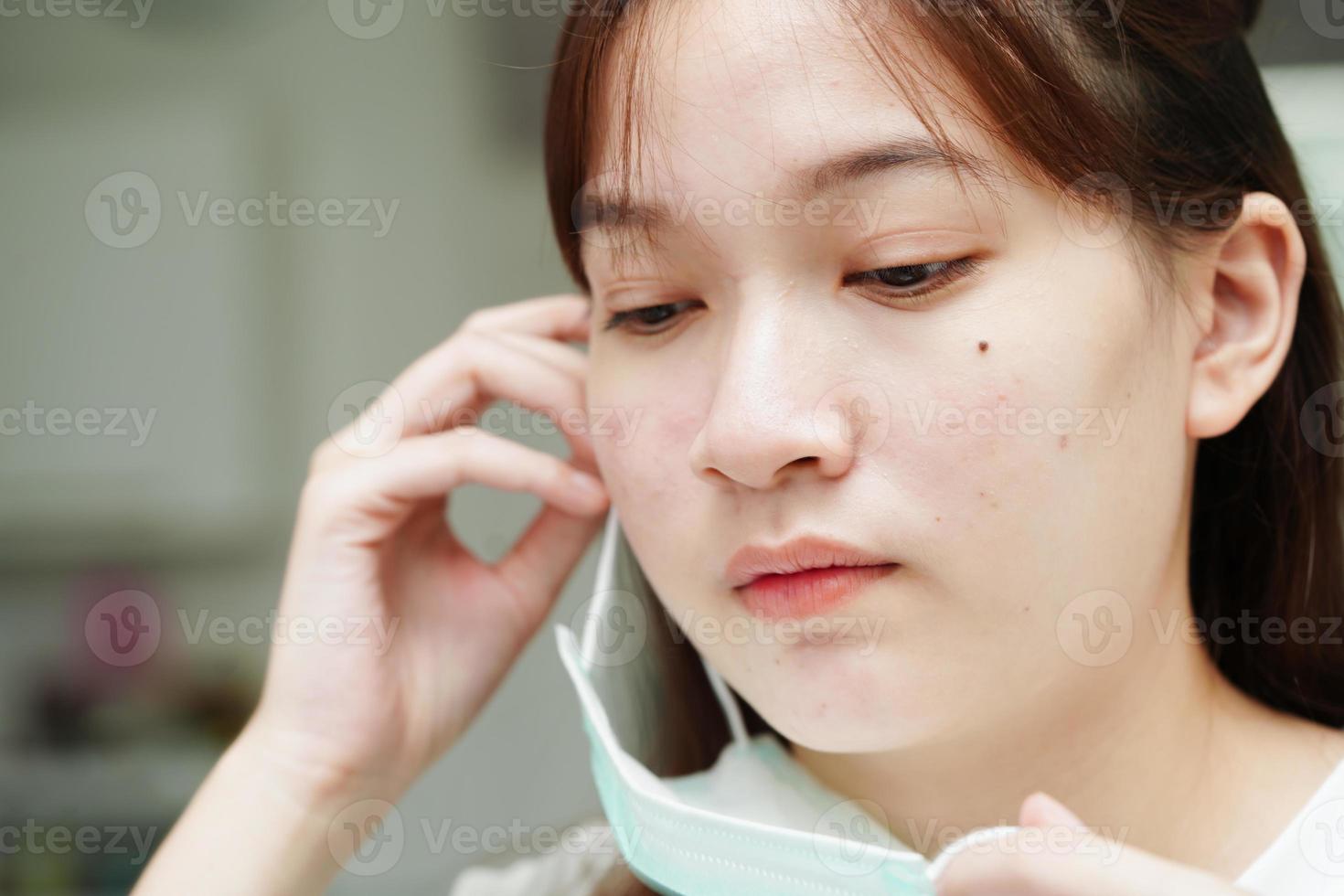 Acne pimple and scar on skin face, disorders of sebaceous glands, teenage girl skincare beauty problem. photo