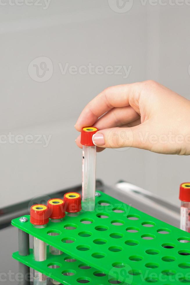 Nurse takes empty blood test tube photo