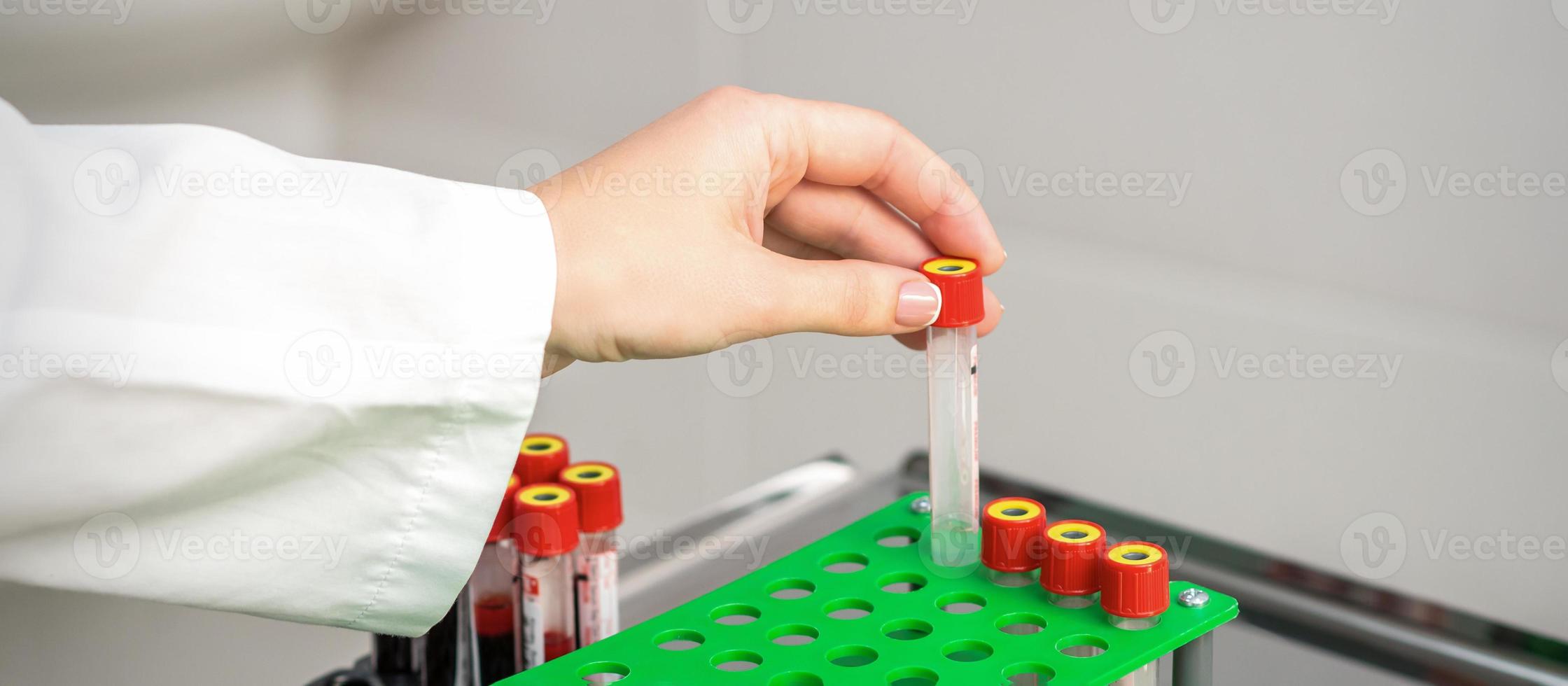 Nurse takes empty blood test tube photo