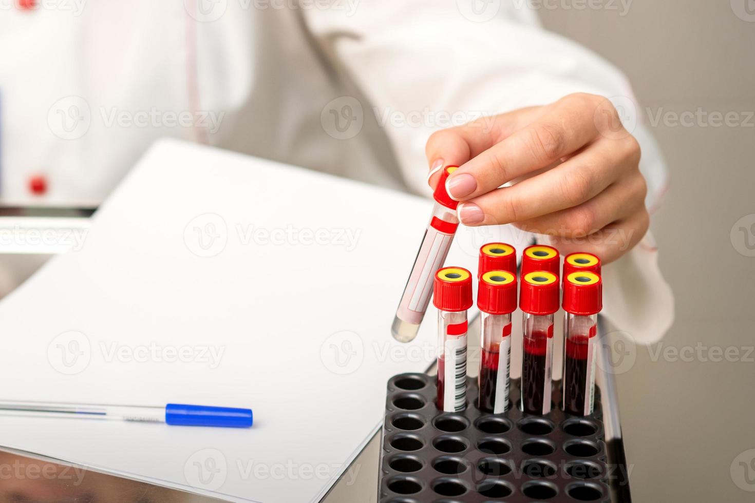 Nurse takes empty blood test tube photo