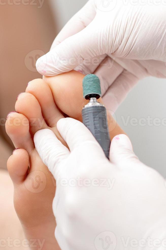 Peeling feet pedicure procedure on foot photo