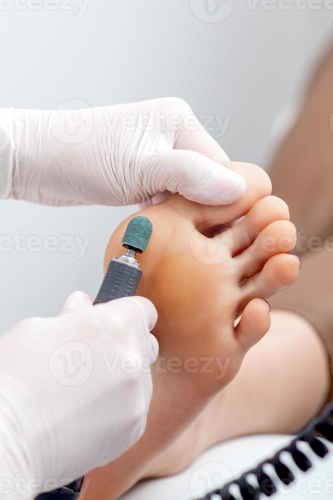 Peeling feet pedicure procedure on foot photo