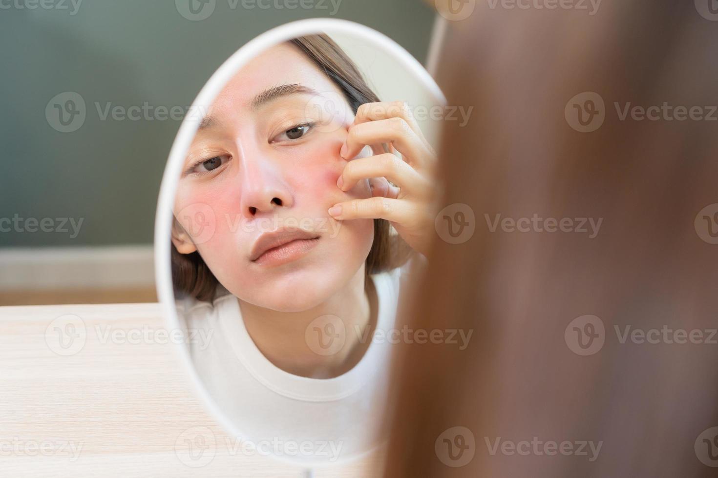 Dermatology, puberty asian young woman, girl looking into mirror, allergy presenting an allergic reaction from cosmetic, red spot or  rash on face. Beauty care from skin problem by medical treatment. photo