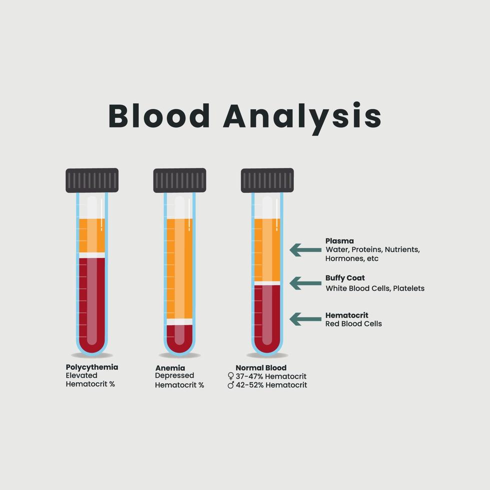 sangre análisis en prueba tubos vector